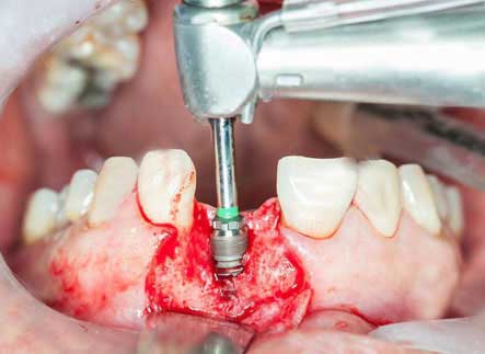 oral surgery courses academy